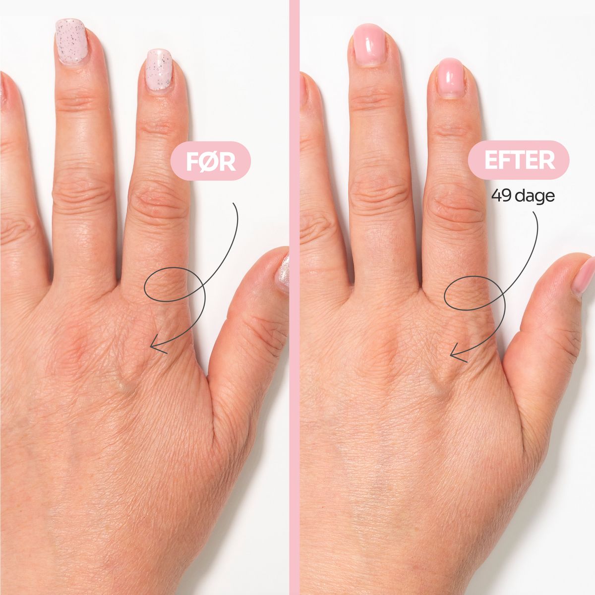 AGE-DEFYING hand cream