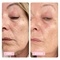 Tora, 62 years old, high sebum production