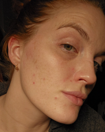 Before - Isabella