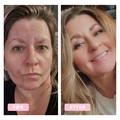 Mona, 47 years old, rosacea and sensitive skin